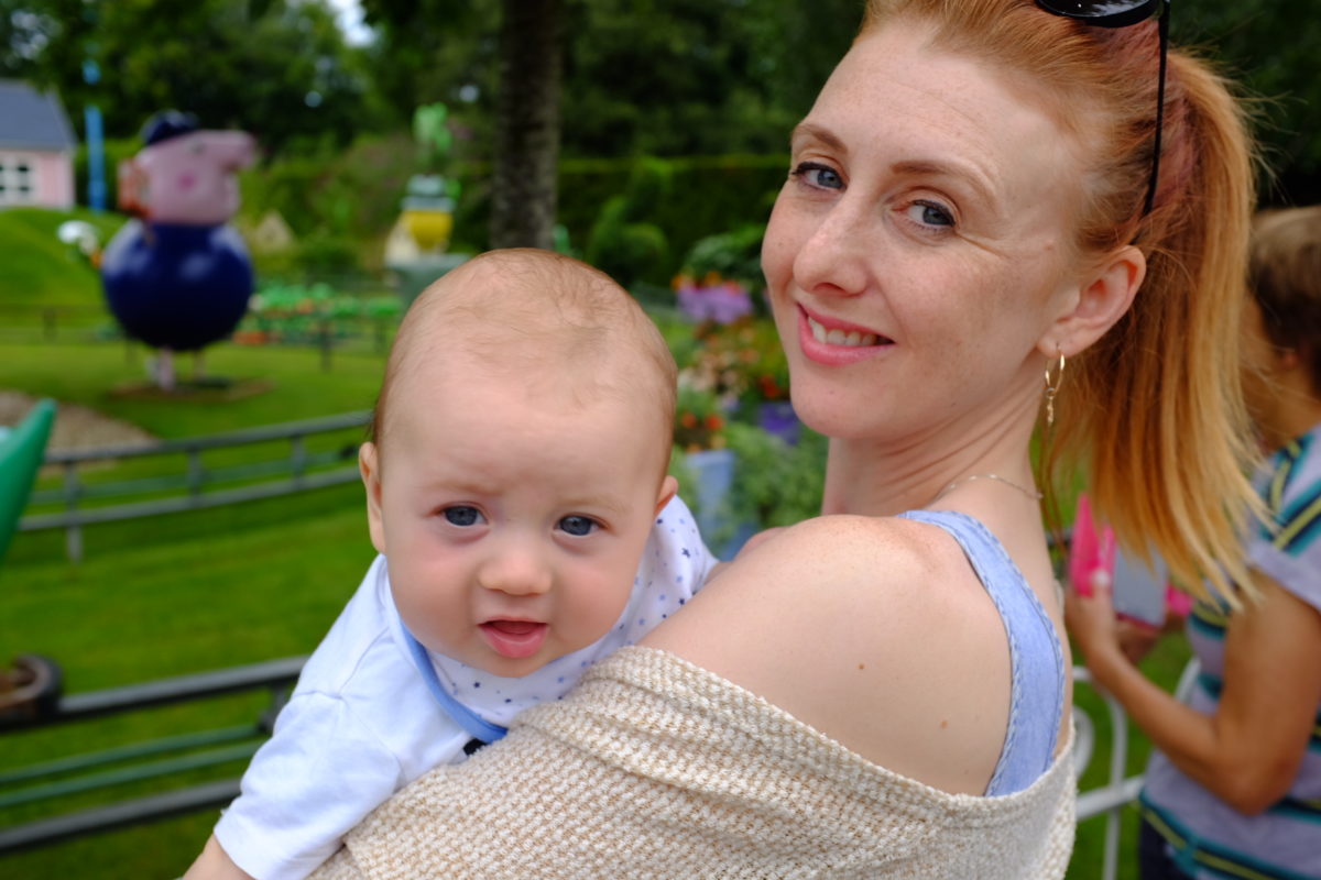 Umbilical Granuloma - Our Baby Boy's Belly Button Has Not Healed