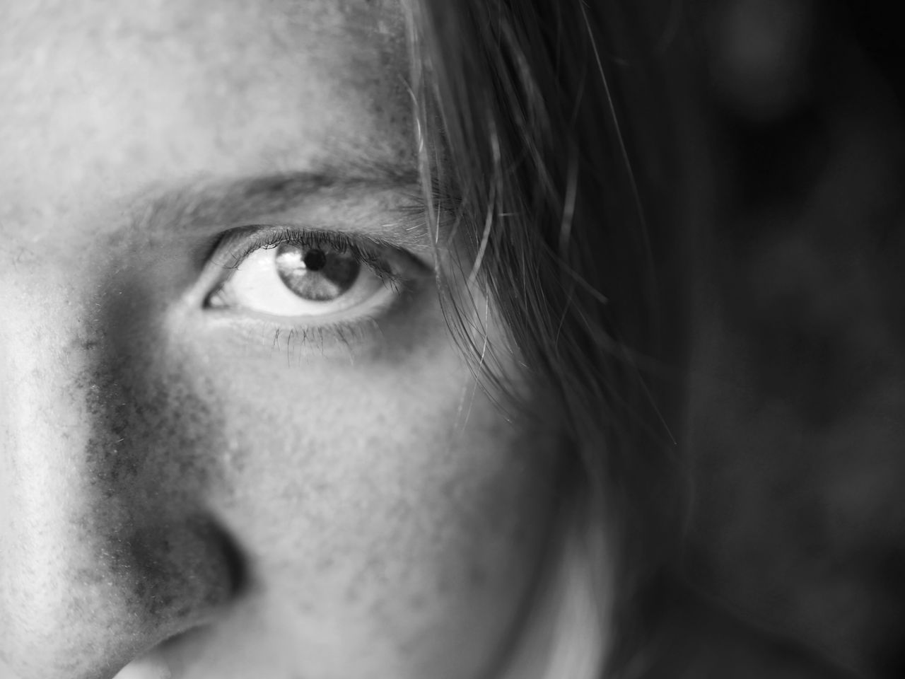 Is Upper Blepharoplasty Really Worth It? Here’s What the Evidence Suggests