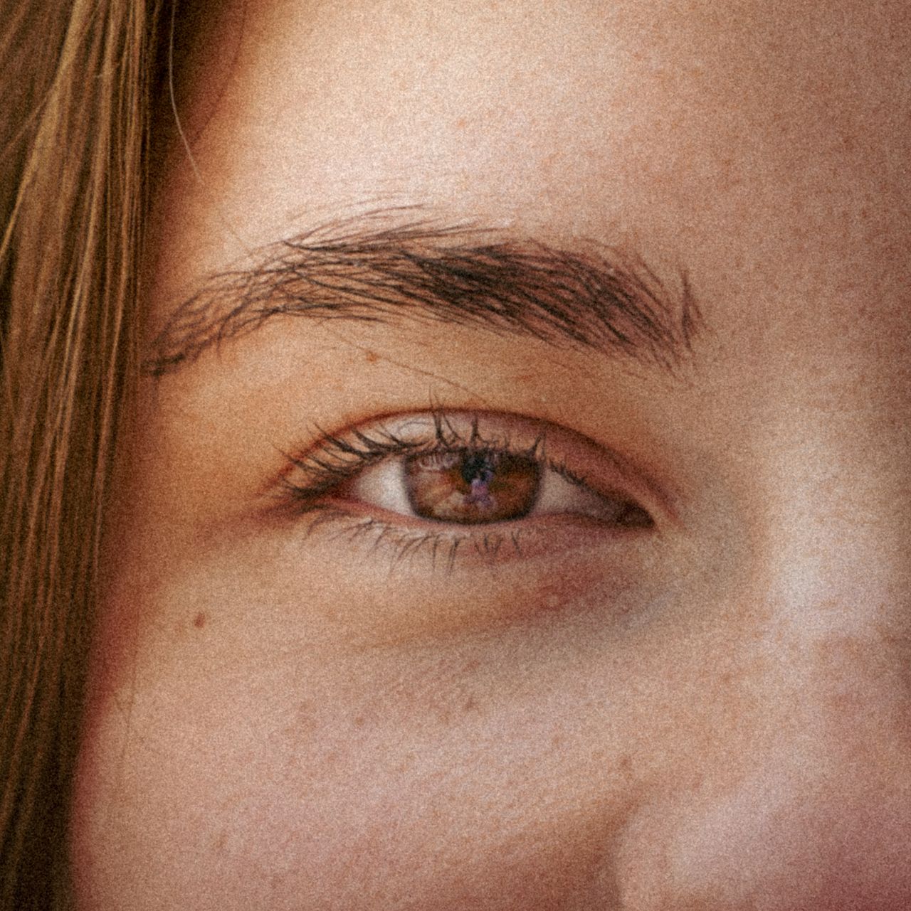 Considering a Brow Lift? 5 Things to Ask Yourself Before Deciding on Surgery